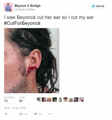 BEYONCE : son oreille coupée en plein concert !