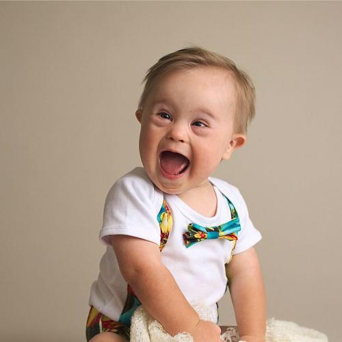 Ce Bebe Trisomique Devient Mannequin Ce Bebe Trisomique Devient Mannequin