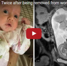Ce BÉBÉ serait NÉ DEUX FOIS dans la MÊME GROSSESSE !
