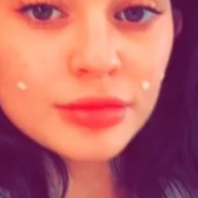 Kylie JENNER a un soin MIRACLE ANTI-BOUTONS