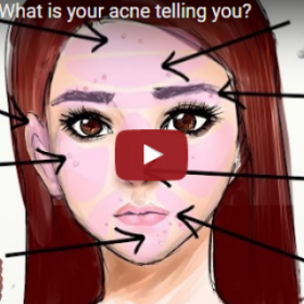 La VIDÉO GÉNIALE pour ENFIN comprendre ce qui cause votre ACNÉ