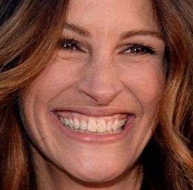 TEST : reconnaîtrez-vous ces STARS rien qu'en voyant leur SOURIRE ?
