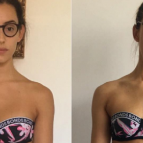 RÉGIME : la PHOTO qui PROUVE que le NOMBRE de CALORIES ne COMPTE PAS !