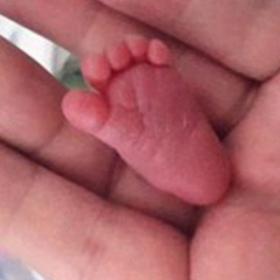 VOICI le BÉBÉ le MOINS GROS du MONDE ! (et elle se porte bien !)