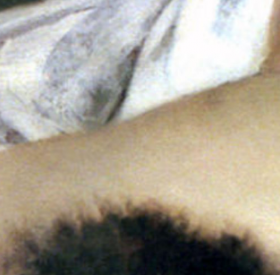 Elles REPLANTENT des CHEVEUX sur leur PUBIS suite à une EPILATION trop INTENSE...