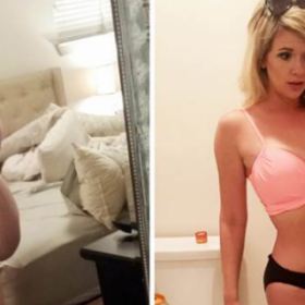 Elle a PERDU 68 KG grâce à la CHIRURGIE !