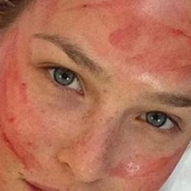 VAMPIRE LIFT: elles s'injectent du SANG pour éviter les RIDES !