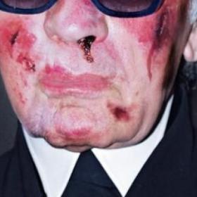 Pourquoi KARL LAGARFELD a t-il été DÉFIGURÉ ?
