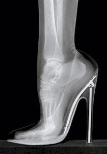 TALONS HAUTS, maux de dos et pieds estropiés...
