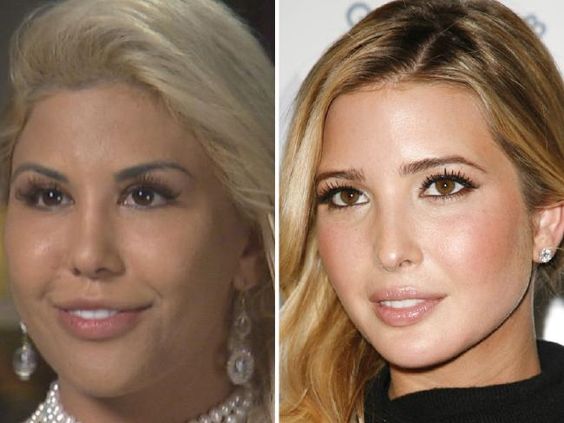 CHIRURGIE : 60 000 dollars pour ressembler à la famille TRUMP