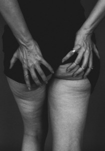 On PARTAGE les photos de sa CELLULITE sur Instagram !
